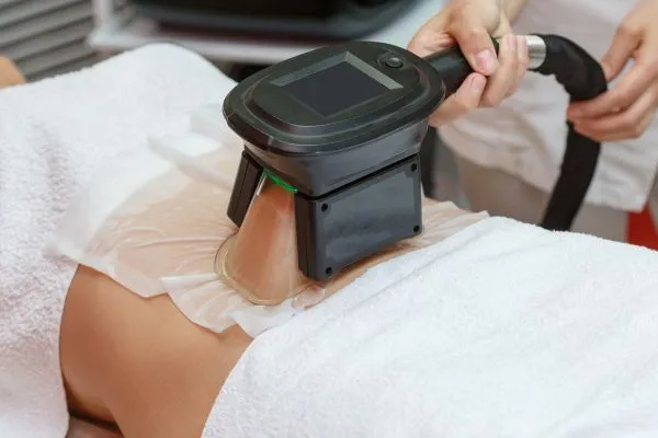 Image of person having fat freezing treatment to help weight gain Glossop