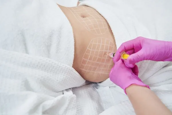 image of fat dissolving injections on love handles to help combat weight gain Glossop
