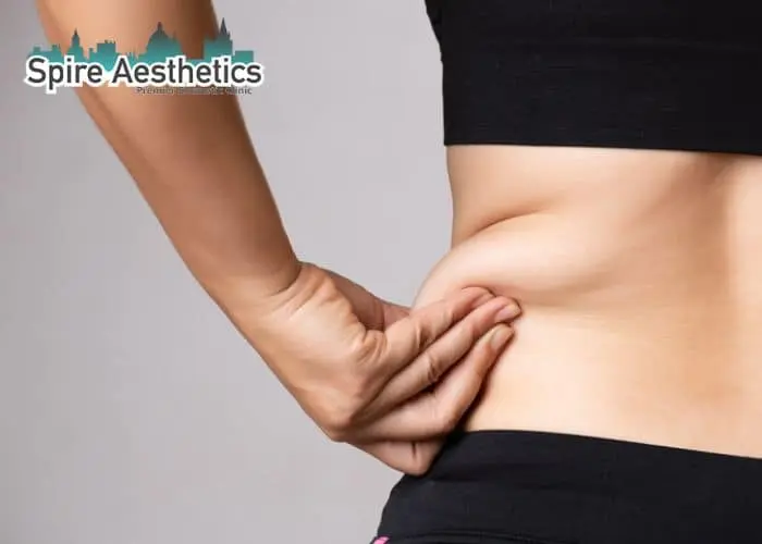 Image of woman pinching fat on their hips Glossop. Fat Freezing treatment