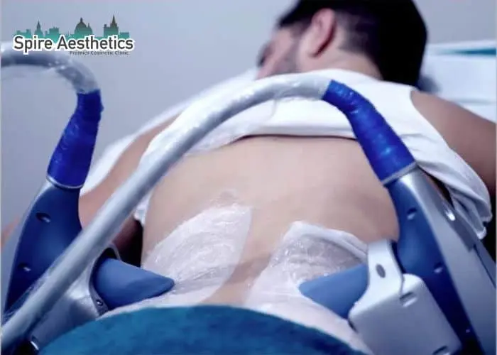 Man having fat freezing treatment done on love handles before a competitions Glossop to create a sculpted look.